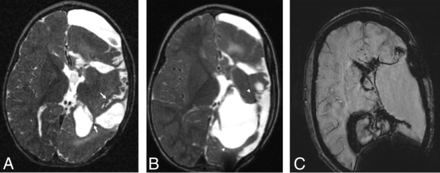 FIG 4.