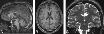 FIG 5.