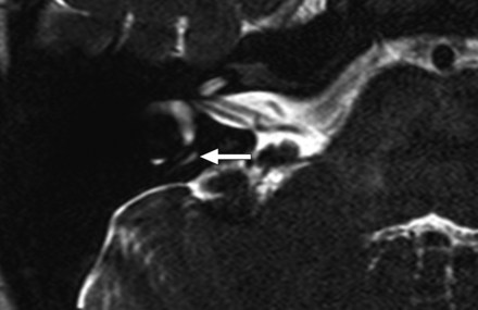 FIG 1.