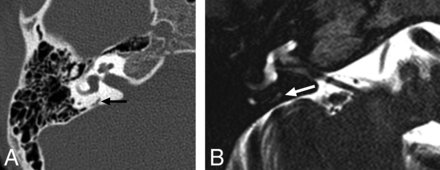 FIG 3.
