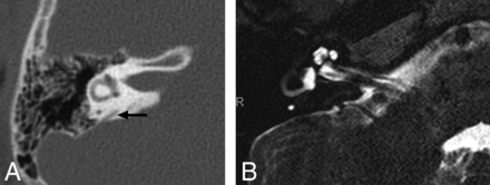 FIG 4.