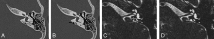 FIG 5.