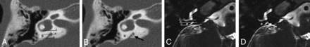 FIG 6.