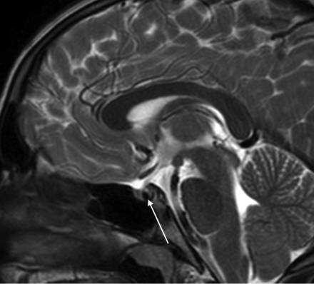 FIG 6.