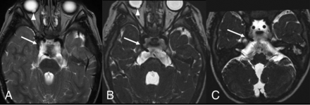 FIG 2.