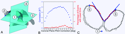 FIG 1.