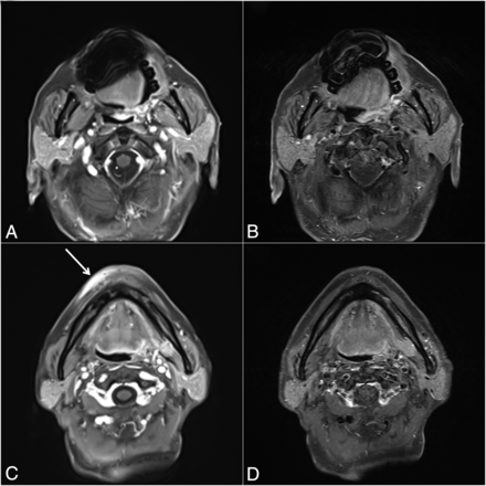 FIG 3.