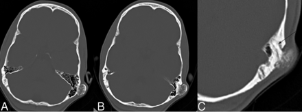 FIG 6.