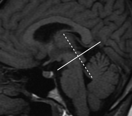 FIG 2.