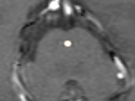 FIG 3.