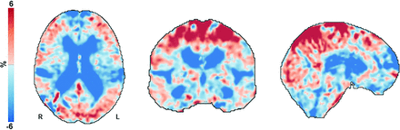 FIG 2.