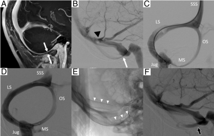 FIG 2.