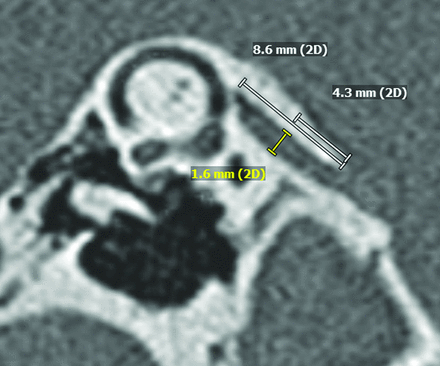 FIG 1.