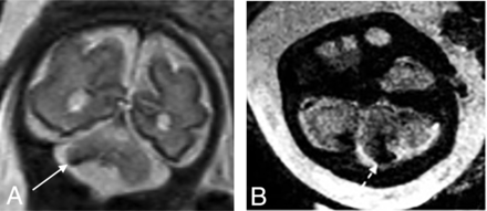 FIG 3.