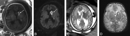 FIG 5.