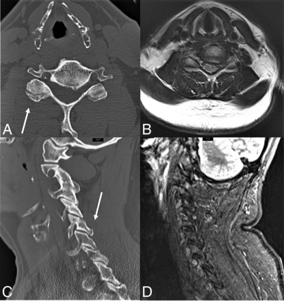 FIG 2.