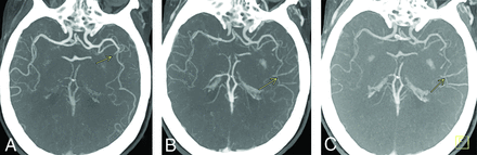 FIG 1.