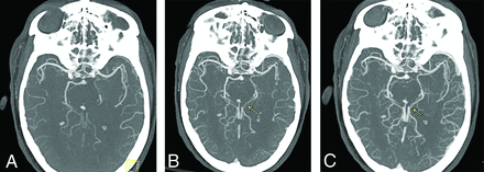 FIG 2.