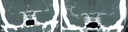 FIG 3.