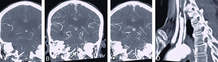 FIG 4.
