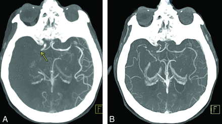 FIG 7.