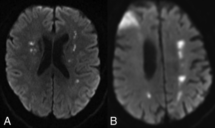 FIG 2.