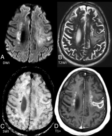 FIG 1.