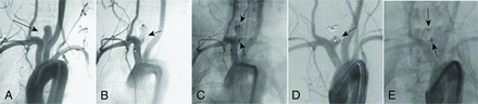 FIG 2.
