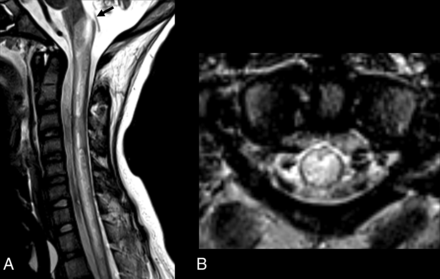 FIG 3.