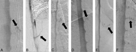 FIG 1.