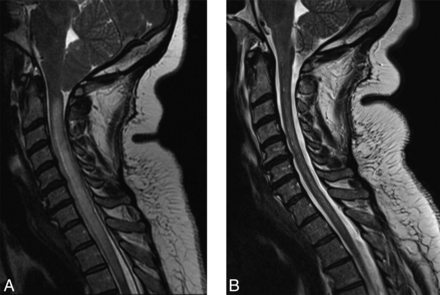 FIG 2.