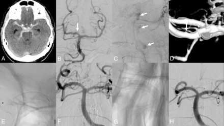 FIG 3.