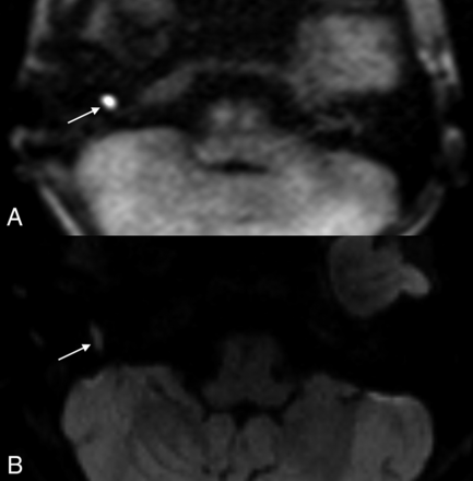 FIG 2.