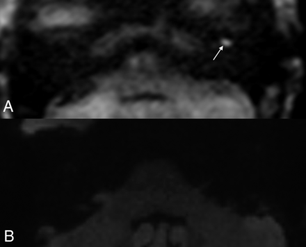 FIG 3.