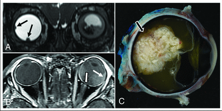 FIG 1.