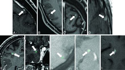 FIG 3.