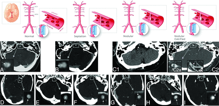 FIG 3.