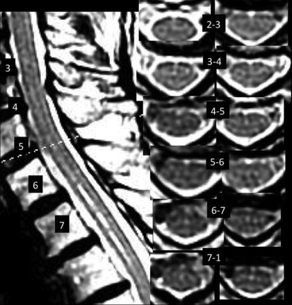 FIG 2.