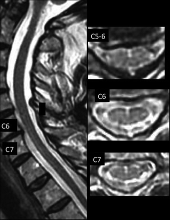 FIG 4.