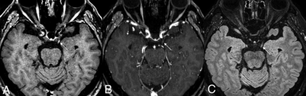 FIG 3.