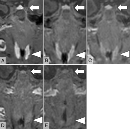 FIG 3.
