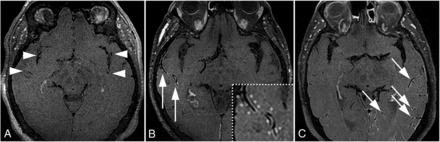 FIG 1.