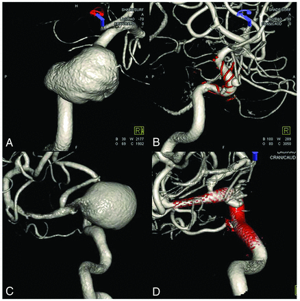 FIG 2.