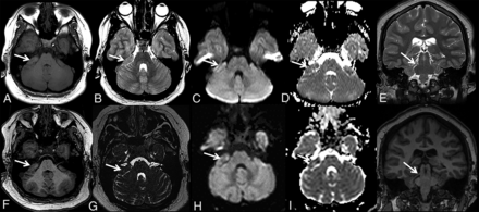 FIG 3.