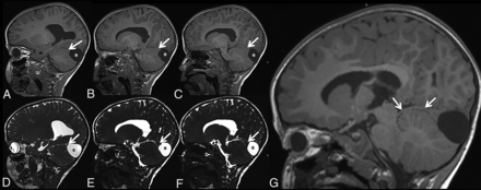 FIG 6.