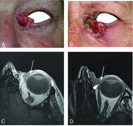 FIG 1.