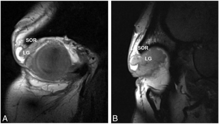 FIG 4.