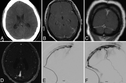 FIG 2.
