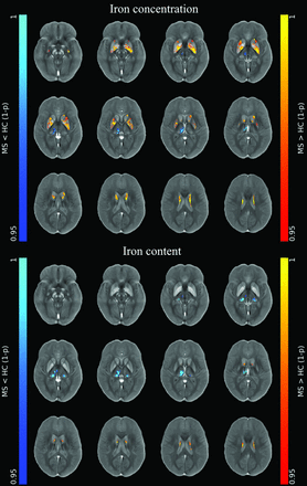 FIG 1.