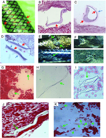FIG 2.